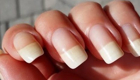 Σπιτικές θεραπείες για πιο λευκά νύχια